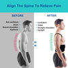 Adjustable Posture Corrector for Men and Women | Back Brace for Pain Relief